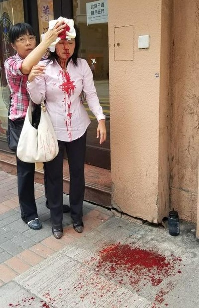 Image for article Praktisi Falun Gong Diserang oleh Dua Orang Preman di Hong Kong