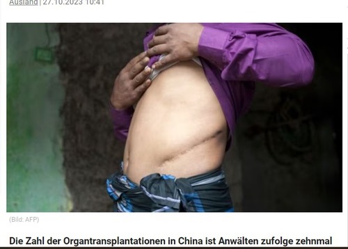 Image for article Austria: Laporan Media Mengenai Pengambilan Organ: “Jangan Menjadi Kaki Tangan Rezim Komunis Tiongkok”