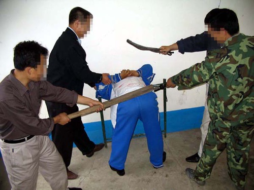Image for article Mantan Pekerja Rumah Sakit Berusia 51 Tahun Disiksa Secara Brutal Saat Menjalani Hukuman Penjara Kedua Karena Berlatih Falun Gong